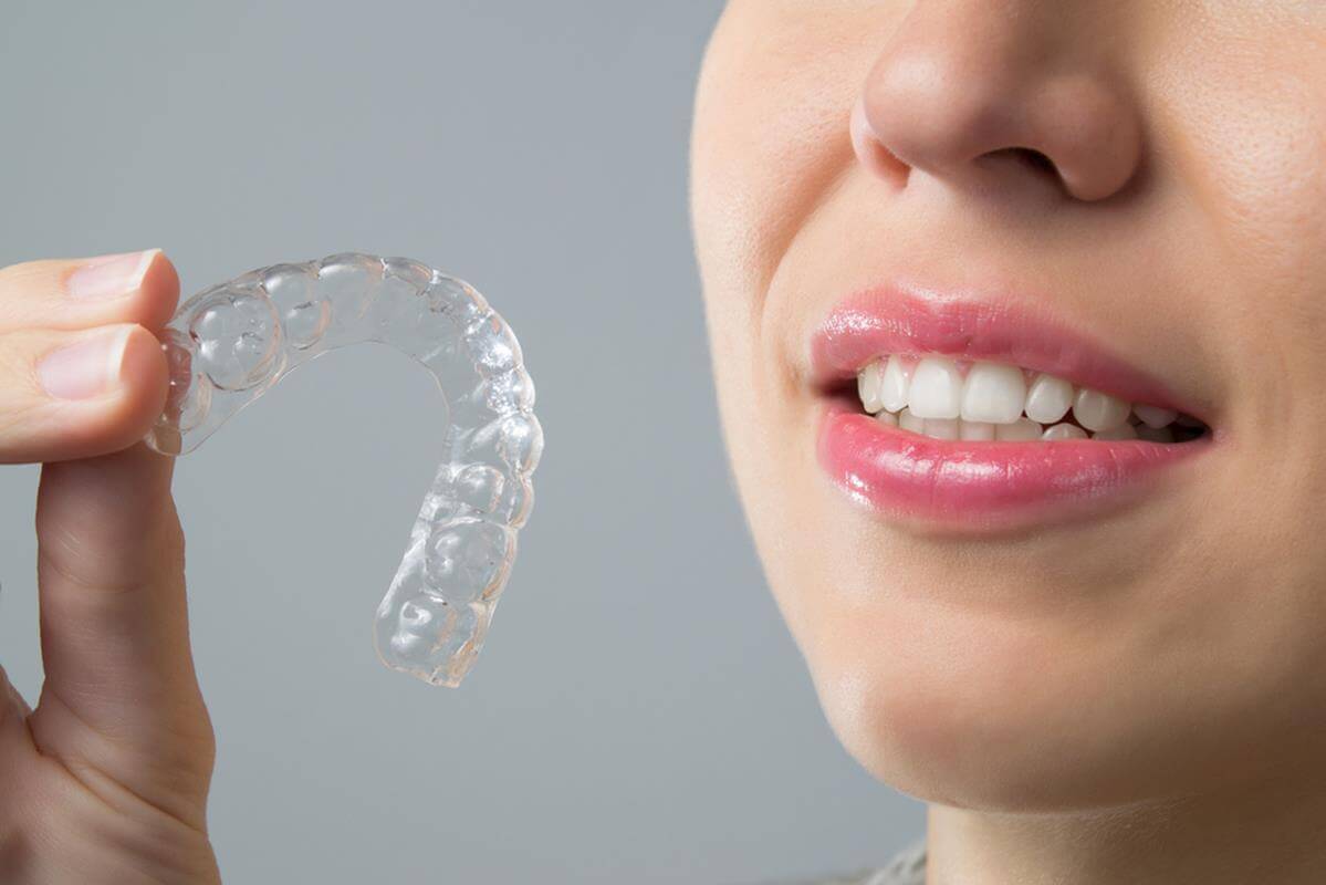 Invisalign Invisalign